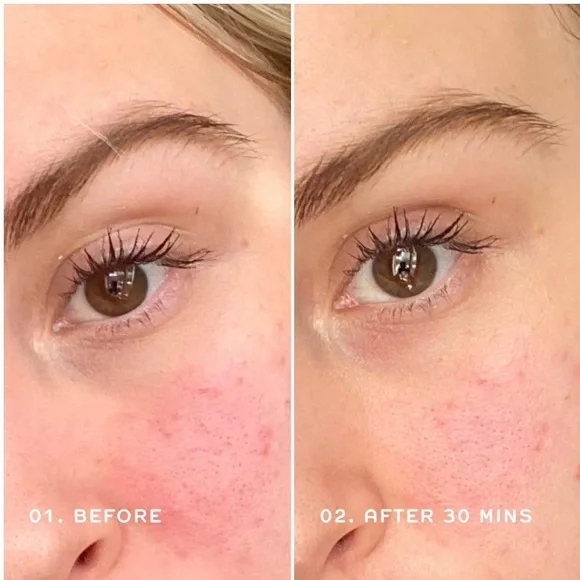 🌿 REN Clean Skincare Evercalm™ Redness Relief Serum - Picture 5 of 8